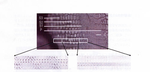 X-ray diffraction map obtained from cross section of <I>Cryptomeria japonica</I>